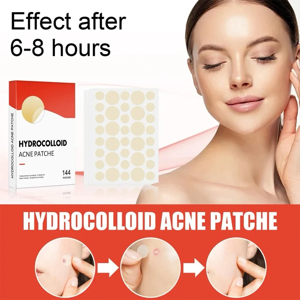 144-Piece Pimple Patches