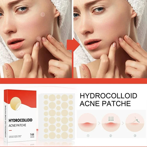 144-Piece Pimple Patches